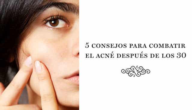 5 Trucos para combatir el acné después de los 30