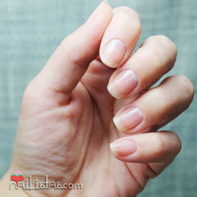 Uñas frágiles y estropeadas | Tratamiento